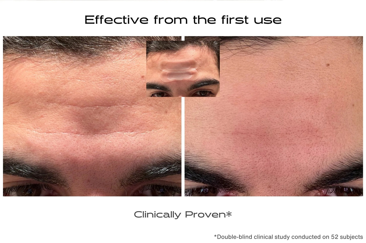 Before and after effects of a skincare product on a person's face, with text indicating effectiveness and clinical provenance.