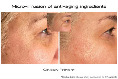 Before and after comparison of eye area with anti-aging ingredients, showing a clinical study result.