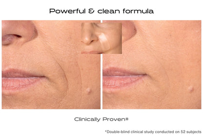 Before and after comparison of skin treatment on a person's face with text indicating a powerful and clean formula.