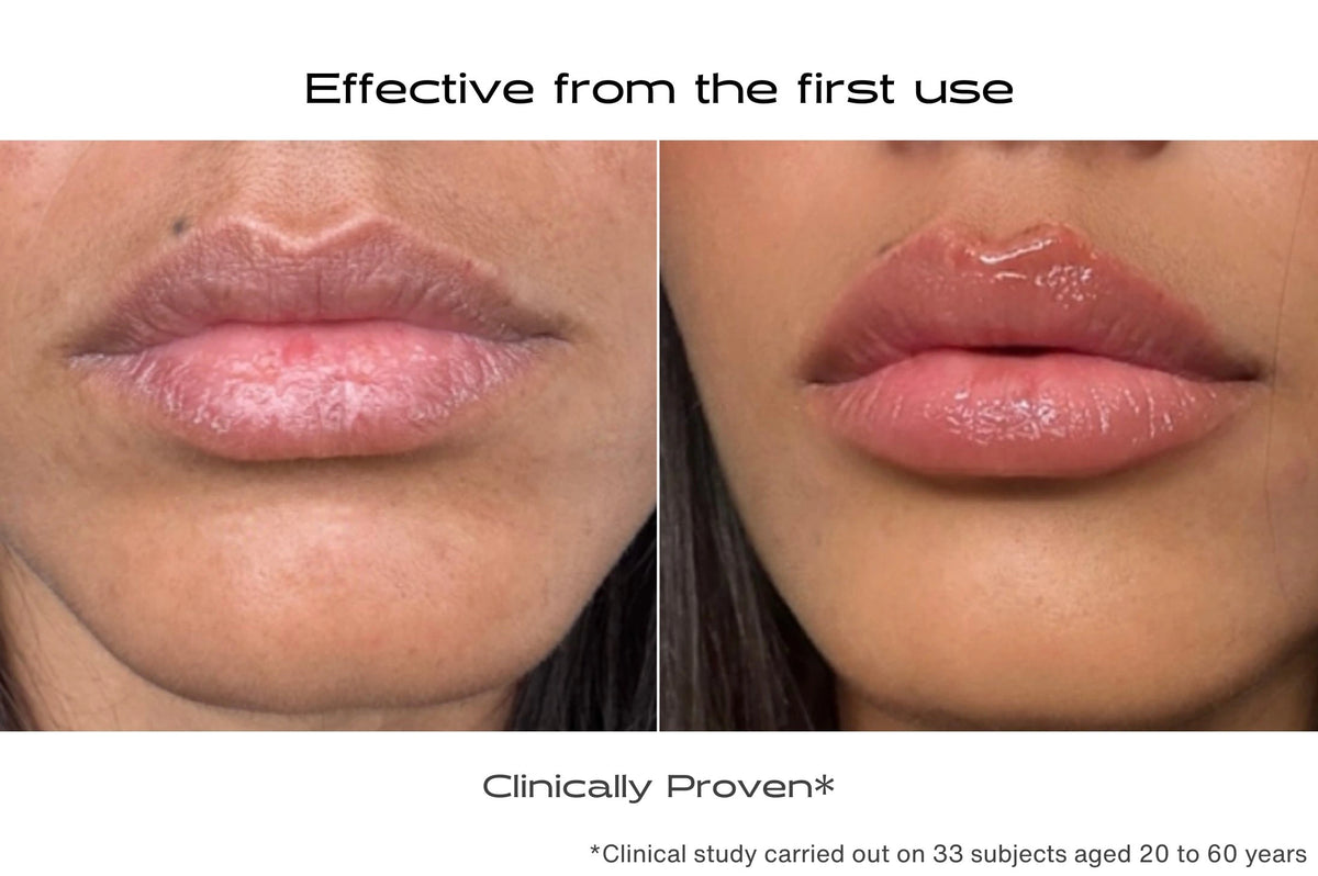 Before and after intense moisturizing and exfoliating lip patch