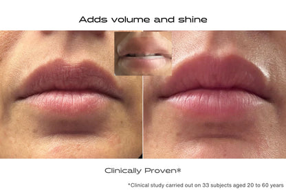 Before and after lip patch to add volume