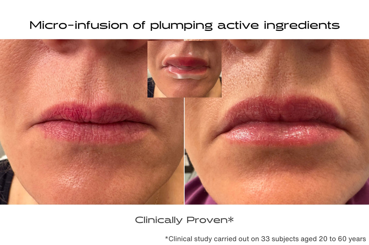 Before and after lip patch to treat lip problems deep down - plumps and smoothes 
