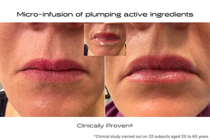 Before and after lip patch to treat lip problems deep down - plumps and smoothes 