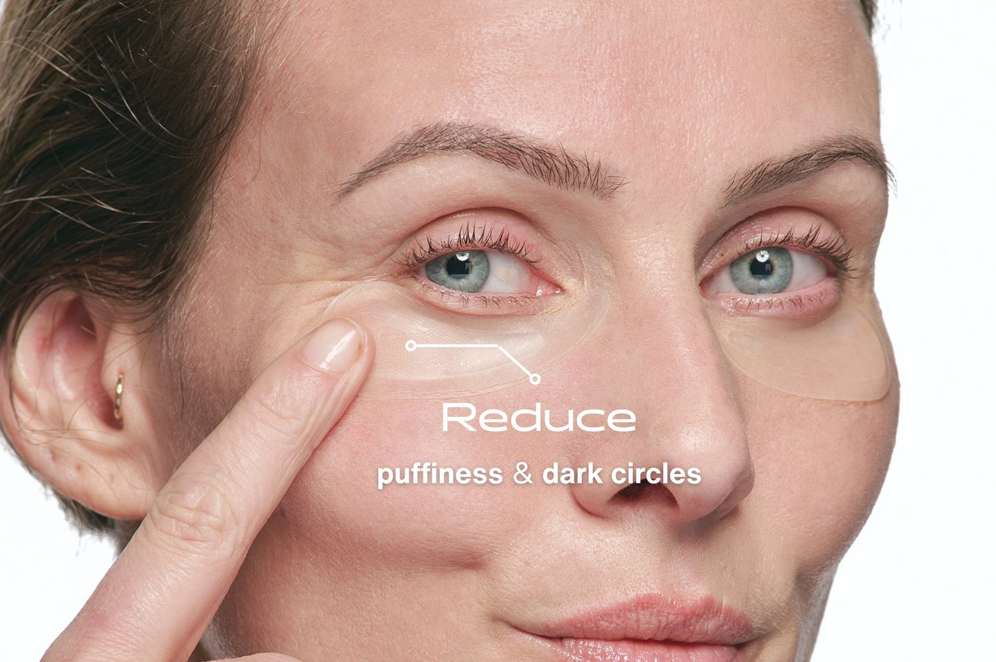 Eye contour patch with microneedles containing active ingredients to treat dark circles, wrinkles, and puffiness